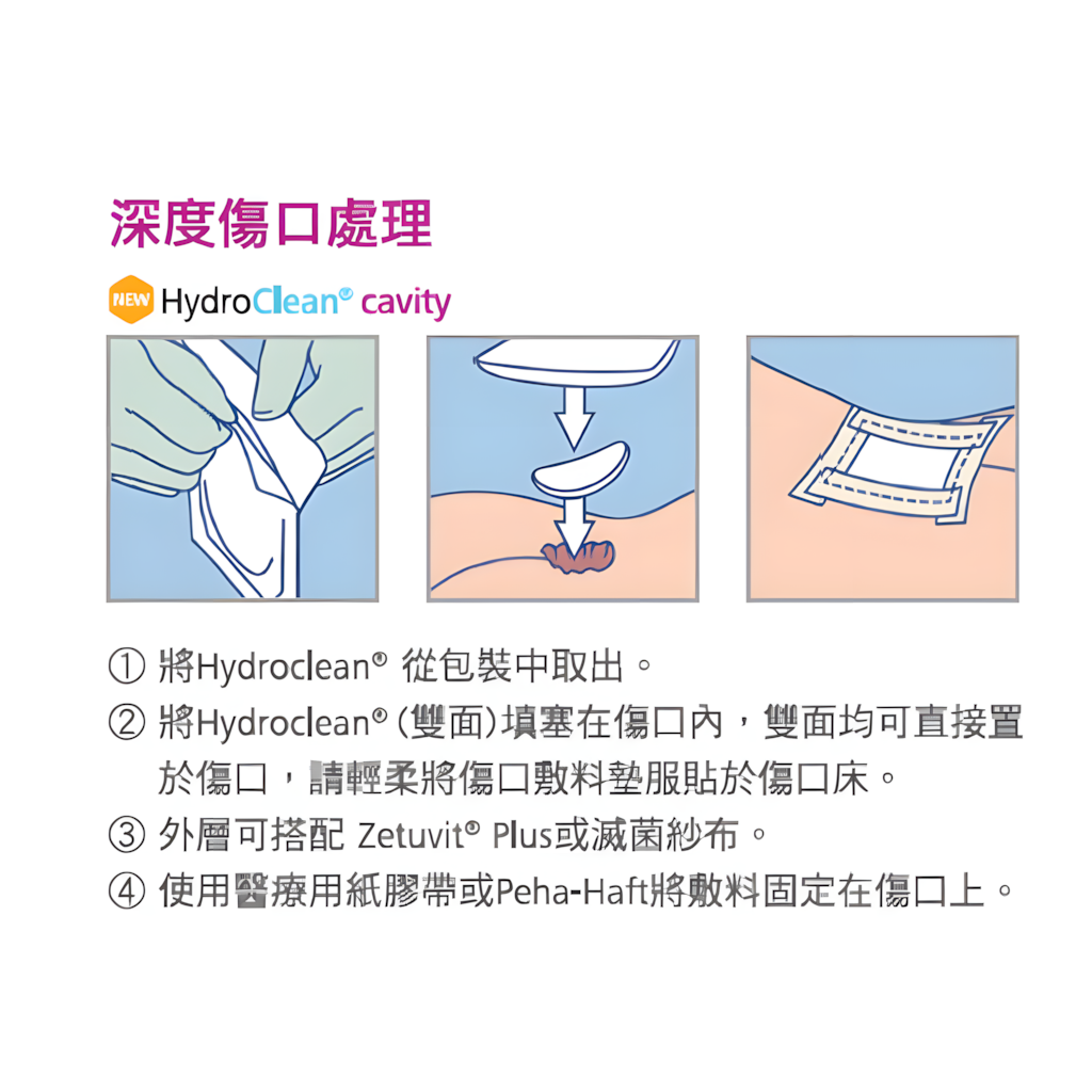 HydroClean Cavity 水活性傷口敷料墊 (雙面填塞型)(10片/盒)