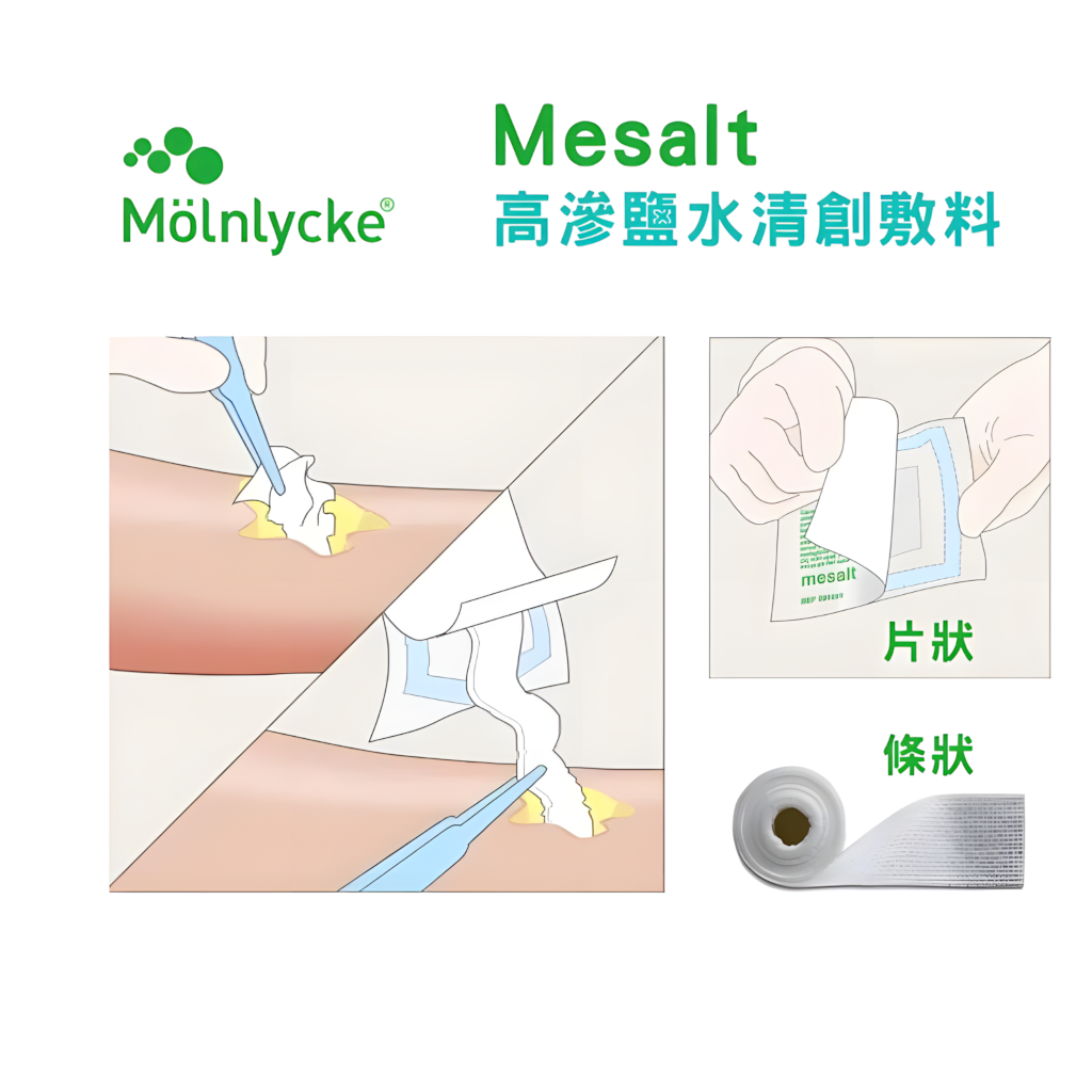 Using Mesalt Mesalt® sodium chloride dressing 7.5*7.5cm (1 piece) – 展耆復康 ElderGen Rehab