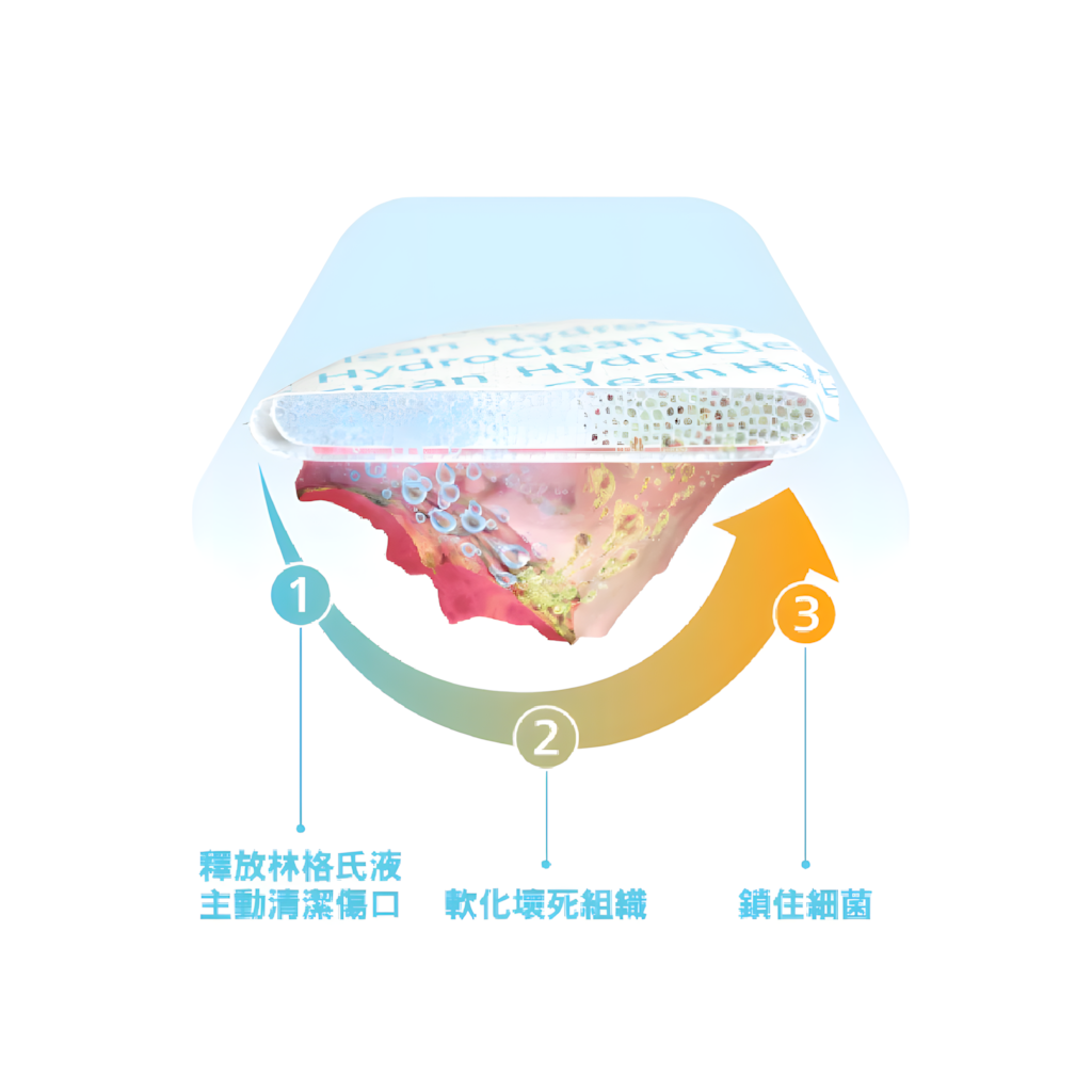 HydroClean Cavity 水活性傷口敷料墊 (雙面填塞型)(10片/盒)